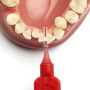 Ершик межзубный TePe ID-brush (25 шт.) 0.5 RED