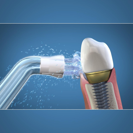 Насадки для имплантов для ирригаторов WaterPik WPS-2E (2 шт)