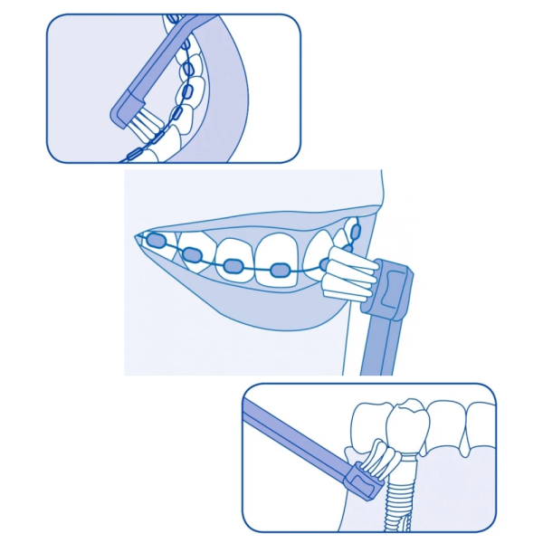 Зубная щетка CURAPROX 708 для имплантов и ортоконструкций (CS 708) ФИОЛЕТОВАЯ